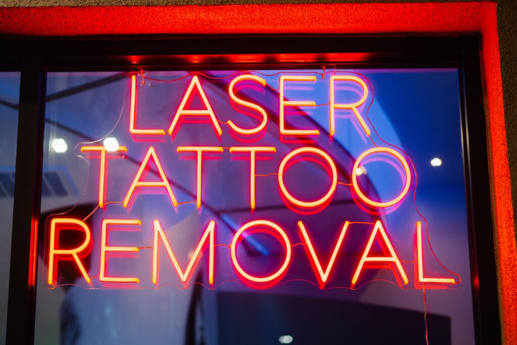 What to Expect After Laser Tattoo Removal